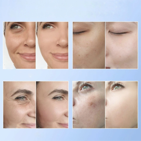 BIO COLLAGEN nawilżająca maseczka kolagenowa na twarz z kwasem hialuronowym - 3